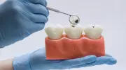 Alimentos e Bebidas que Danificam o Esmalte Dentário: Riscos e Prevenção