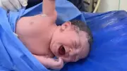 Bebê recém-nascido se recusa a soltar luva de médico e vídeo viraliza