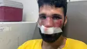 DJ é agredido por entregadores ao ser confundido com ladrão de bicicleta no RJ