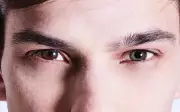Empresário de Rio Preto celebra heterocromia: 'Olhos de cores diferentes'