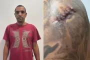 Homem de 46 anos é esfaqueado durante tentativa de assalto em Praia Grande, SP