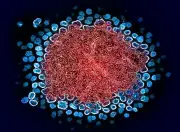 Homem de 63 anos atinge remissão do HIV após transplante de medula óssea do irmão