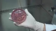Hospital Estadual de Sumaré identifica 14 pacientes com bactéria KPC multirresistente