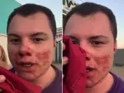 Influenciador em coma após agressão em festa universitária em São Carlos