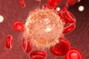 Leucemia Mieloide Aguda: Nova Estratégia Transforma Tratamento para Idosos no Brasil