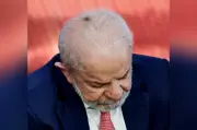 Lula passará por retirada de queratose e infiltração no punho nesta sexta