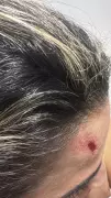 Mulher é agredida pelo namorado durante festa de aniversário em Santa Helena