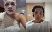 Nutricionista sofre queimaduras em 33% do corpo durante faxina em Goiânia