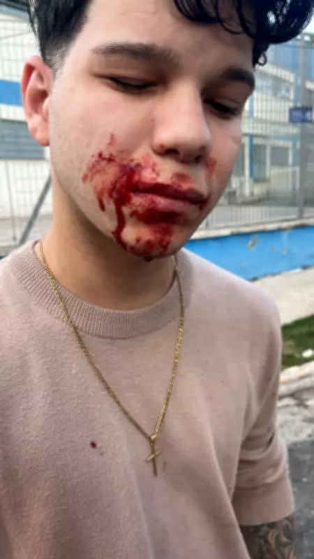 "A janela explodiu na minha cara": jovem ferido em explosão no Jaguaré, SP