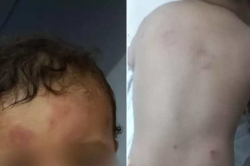 Bebê de 1 ano sofre mordidas e hematomas em creche de Guarujá; mãe denuncia negligência