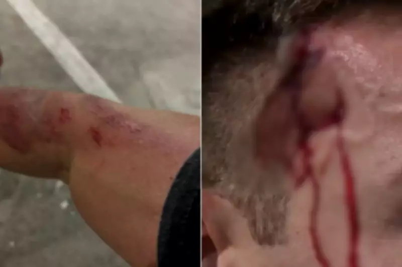 Guarda-vidas ferido após assalto por ladrões de bicicleta em Guarujá