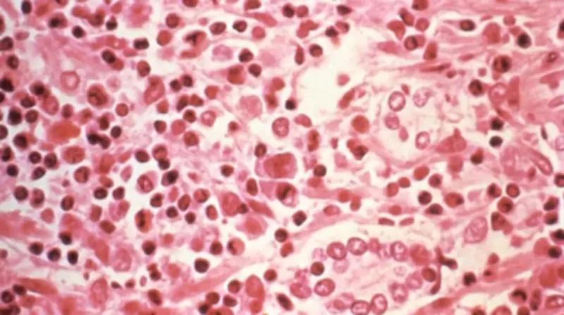 Infectologista explica contágio e sintomas do hantavírus no RS