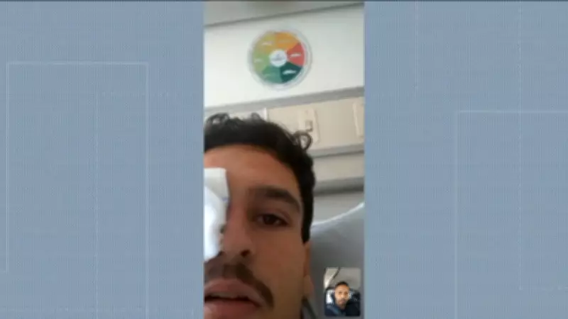 Jovem perde visão após bala de borracha no Maracanã e denuncia falta de socorro da PM