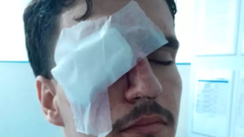Jovem perde visão após ser atingido por bala de borracha em confusão pós-jogo