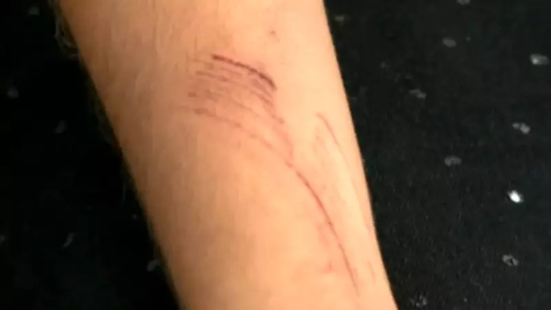 Jovem pula do segundo andar para fugir de marido armado em Cariacica