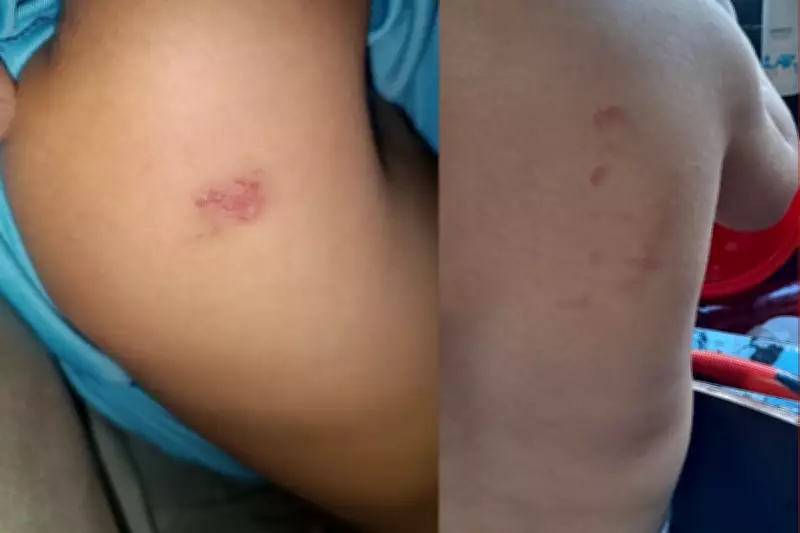 Mãe denuncia professora por hematomas em filho de 2 anos em Sinop