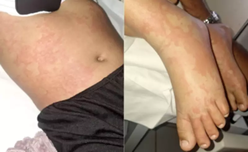 Menina de 10 anos internada após suspeita de contaminação por detergente Ypê