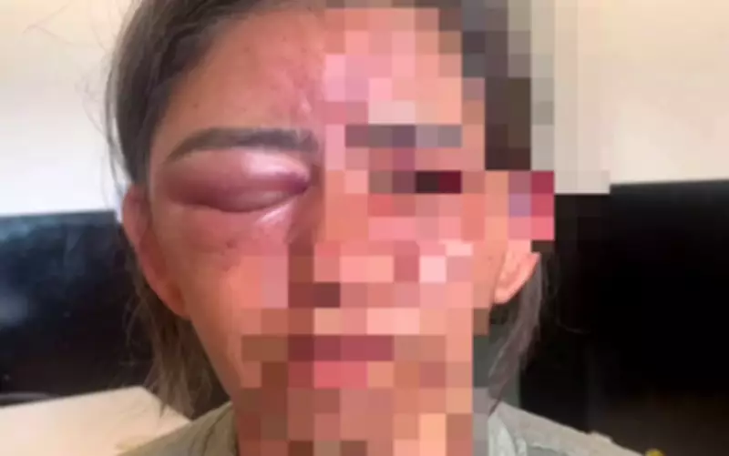 Mulher é estrangulada e espancada até desmaiar por amigo do filho em Goiás