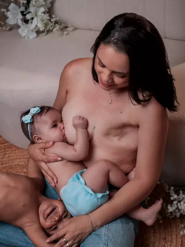 Mulher que perdeu mama em câncer faz ensaio amamentando filha em RO