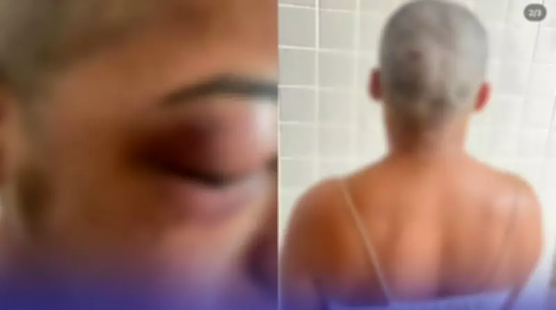 Mulher tem cabelo raspado e sofre atentado a tiros no Pará