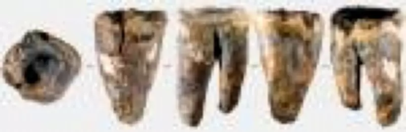 Neandertais já faziam tratamentos dentários há 59 mil anos, revela fóssil