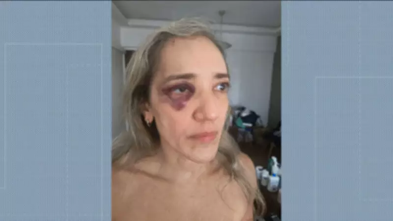 Passageira agredida por motociclista de app na Zona Sul do Rio