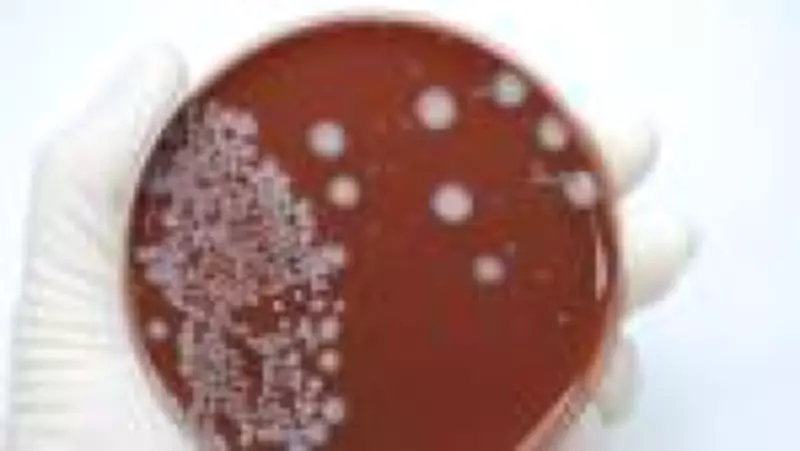 UE barra carne brasileira por uso excessivo de antimicrobianos na pecuária