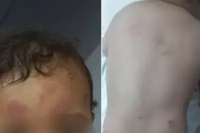 Bebê de 1 ano sofre mordidas e hematomas em creche de Guarujá; mãe denuncia negligência
