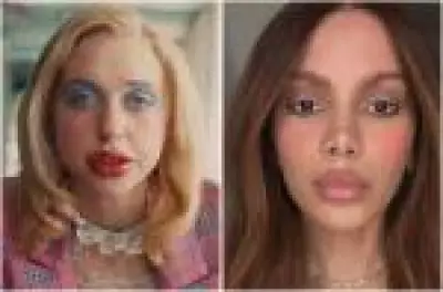 De Anitta a Chloe Cherry: especialistas alertam sobre excesso de preenchimento labial