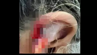 Homem arranca parte da orelha da avó com mordida e é preso em Goiás