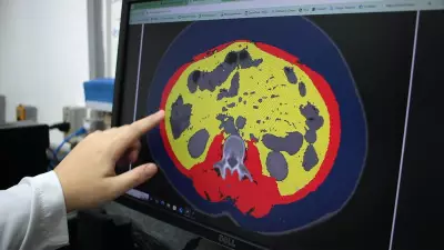 IA da Unicamp mapeia músculo e gordura de pacientes com câncer em menos de 1 minuto
