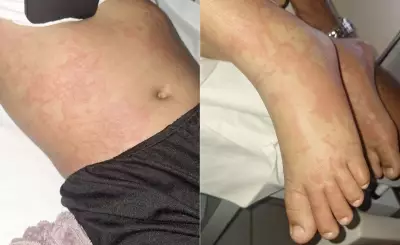 Menina de 10 anos internada após suspeita de contaminação por detergente Ypê