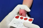 Ampliação do teste do pezinho para AME ainda não saiu do papel no Brasil