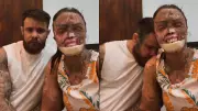 Influencer cearense com doença rara revela diagnóstico de metástase óssea