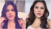 Jovem que teve mão amputada pelo namorado recebe alta da UTI