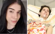 Jovem que teve reação alérgica grave ao cheirar pimenta é internada na UTI
