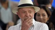 Lula inicia radioterapia preventiva contra câncer de pele no couro cabeludo