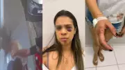 Mecânico agride esposa com socos em via pública no Piauí; vítima relata histórico de violência