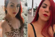 Mulher morre após cirurgia plástica de 'mommy makeover' em SP