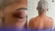 Mulher tem cabelo raspado e sofre atentado a tiros no Pará