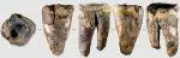 Neandertais já faziam tratamentos dentários há 59 mil anos, revela fóssil