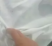 Paciente denuncia carrapatos em lençóis de maternidade em Boa Vista