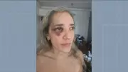 Passageira agredida por motociclista de app na Zona Sul do Rio