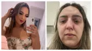 Vítima de agressão brutal denuncia maus-tratos em delegacia da mulher em SP
