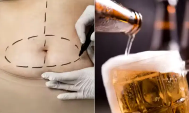 Absorção de álcool quase dobra após cirurgia bariátrica, diz estudo