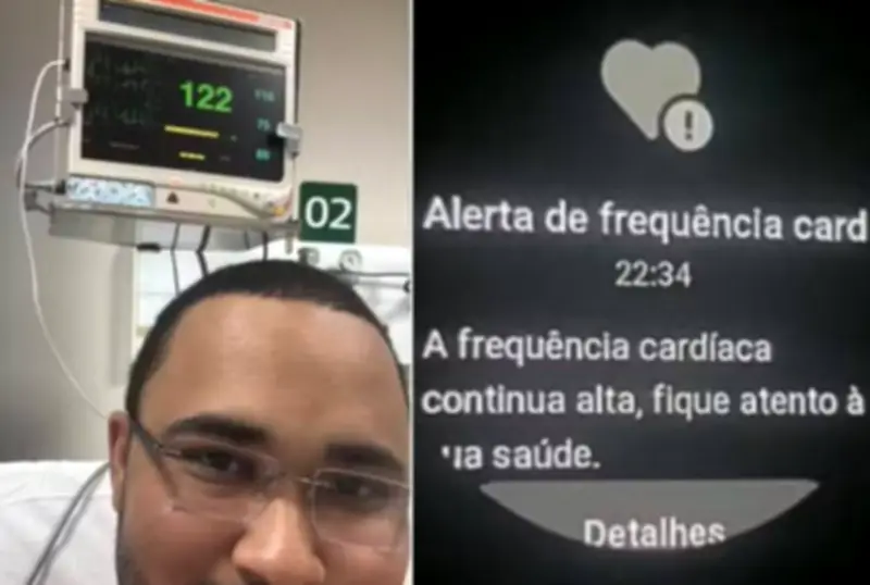 Alerta de smartwatch leva analista à UTI com fibrilação atrial