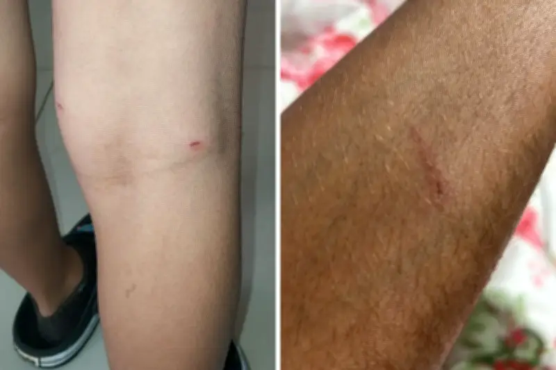 Cachorro invade escola e morde três crianças em Nova Odessa