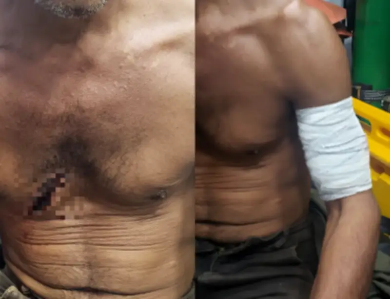 Caseiro é atacado a facão em garimpo em Alto Alegre, RR