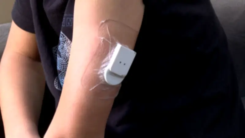 Famílias esperam sensores de glicemia para crianças com diabetes no PR