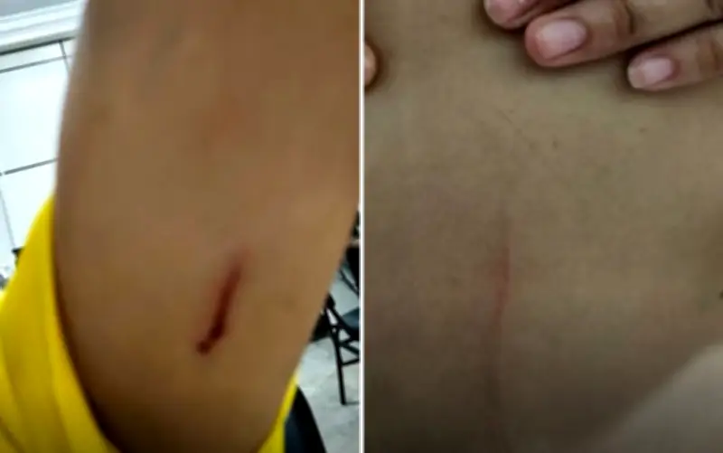 Funcionária é atacada com tesoura por colega após denunciar descumprimento de regra